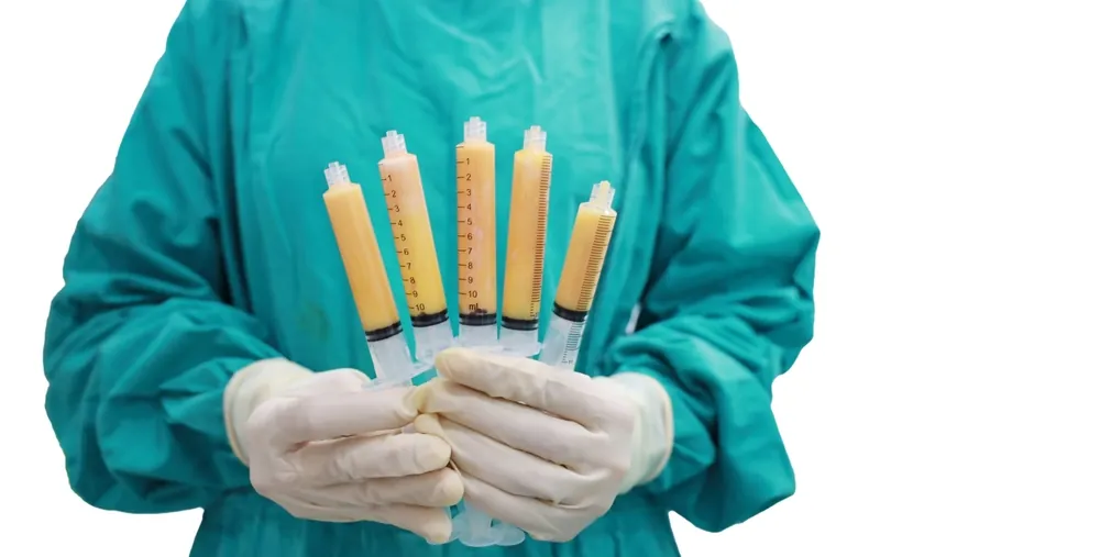 best fat transfer surgeon in Washington DC