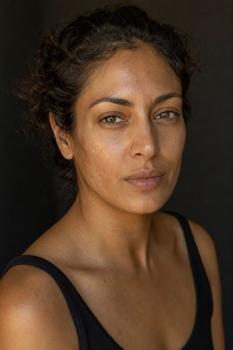 Tan skin with visible texture and uneven tone