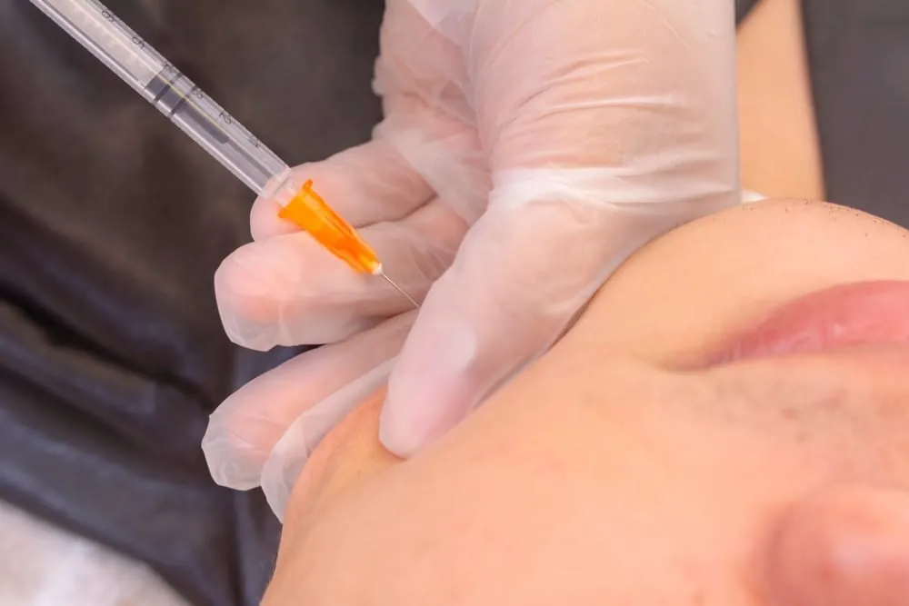 patient getting filler for facial feminization in DC