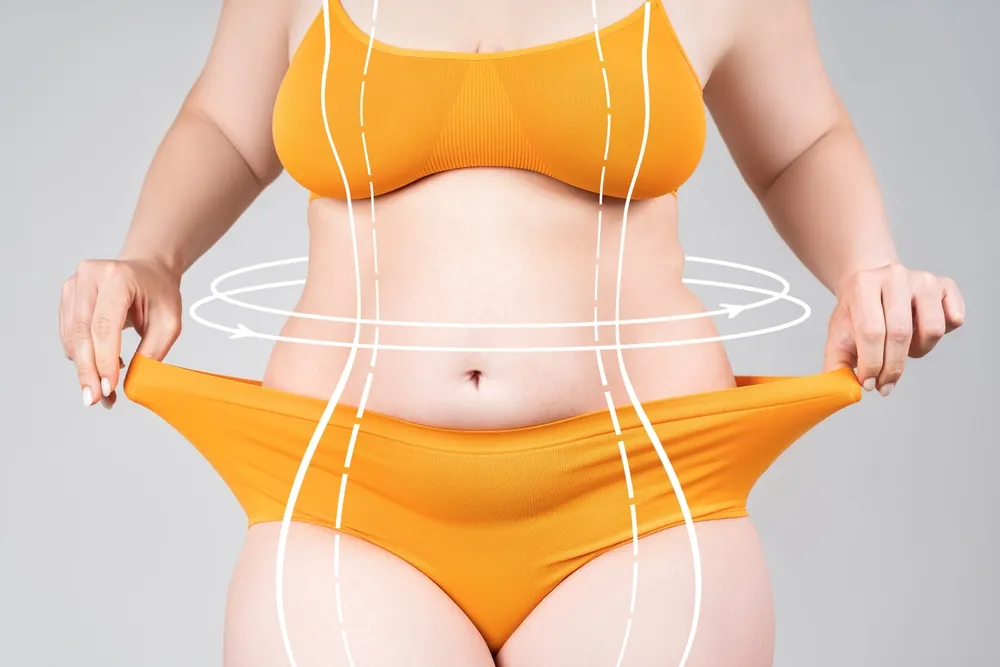 Best Areas for Liposuction Contouring in Washington, D.C.