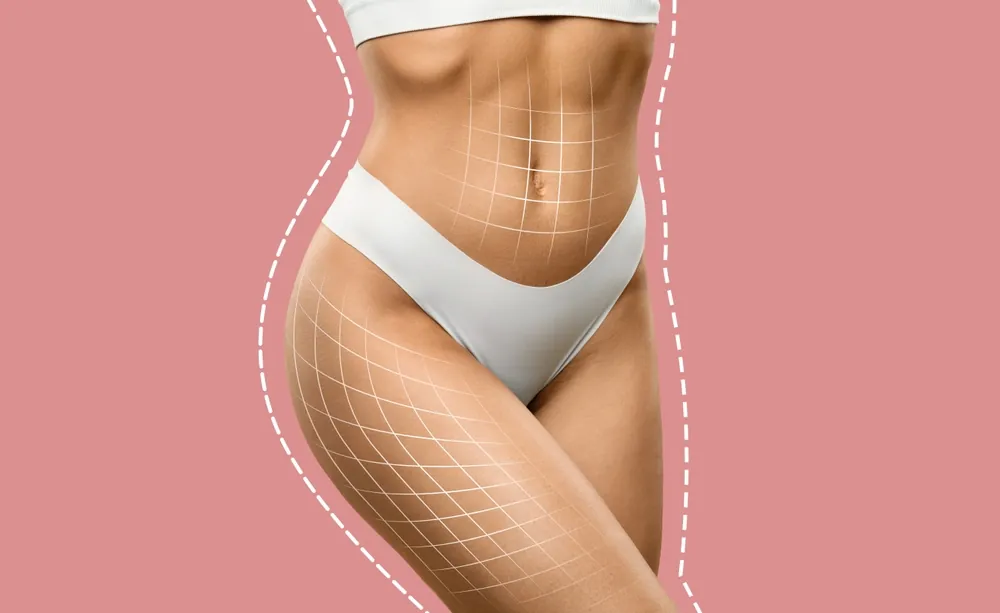 How Much Fat Does Laser Liposuction Take?