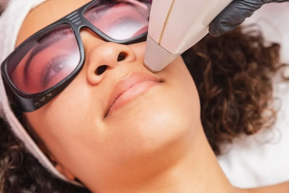 laser hair removal for dark skin in Washington DC