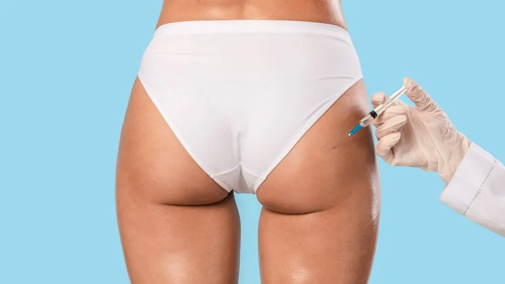 sculptra butt lift DC