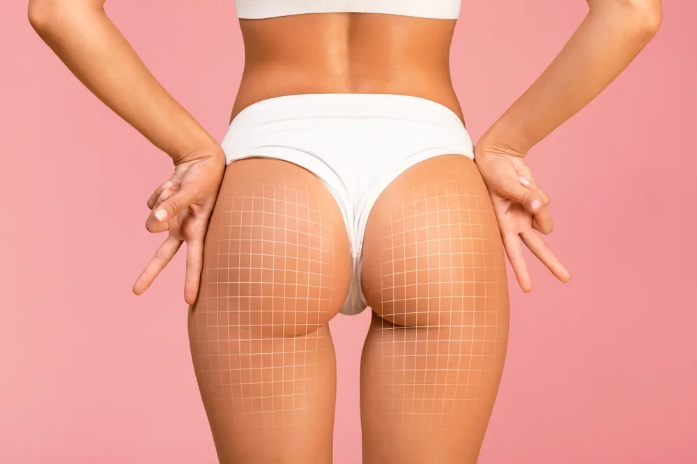Brazilian Butt Lift in Washington, DC: Sculpt, Lift, and Love Your Curves