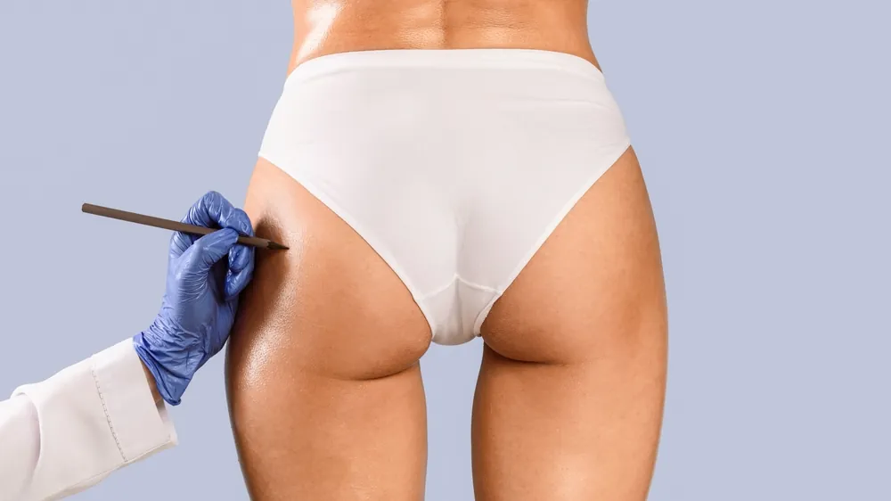 Brazilian Butt Lift Cost in Washington DC, Explained