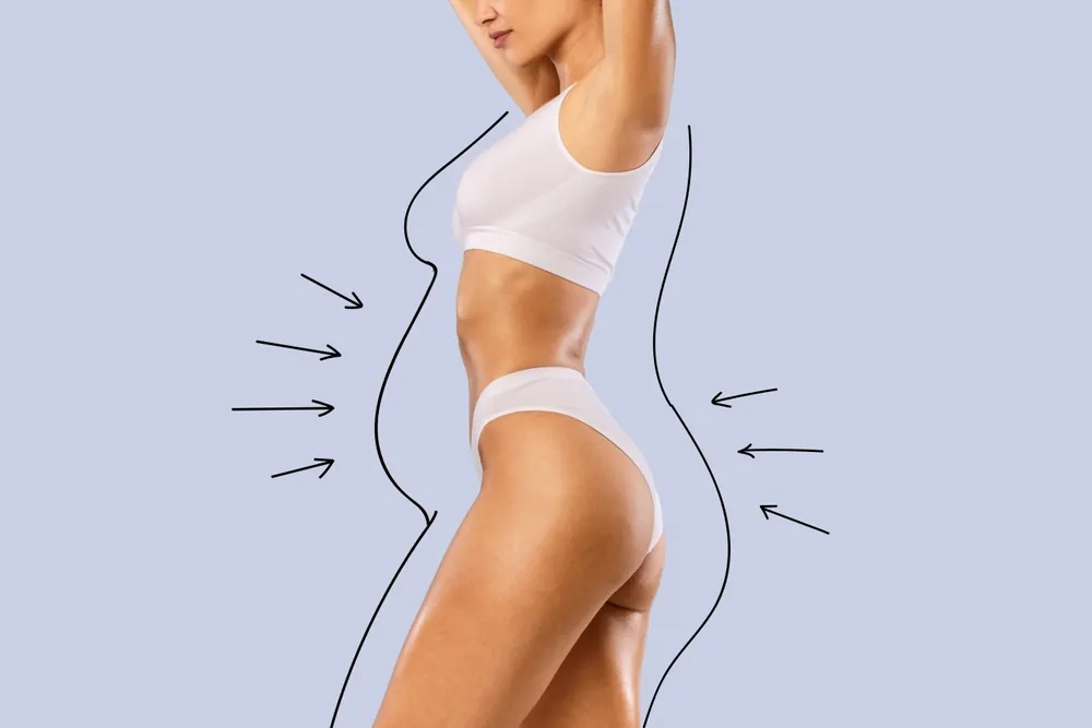 Is Liposuction Right for You? A Comprehensive Guide for D.C. Patients