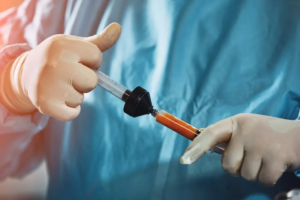 Fat Transfer Breast Augmentation Cost in Washington, DC: Your Questions Answered