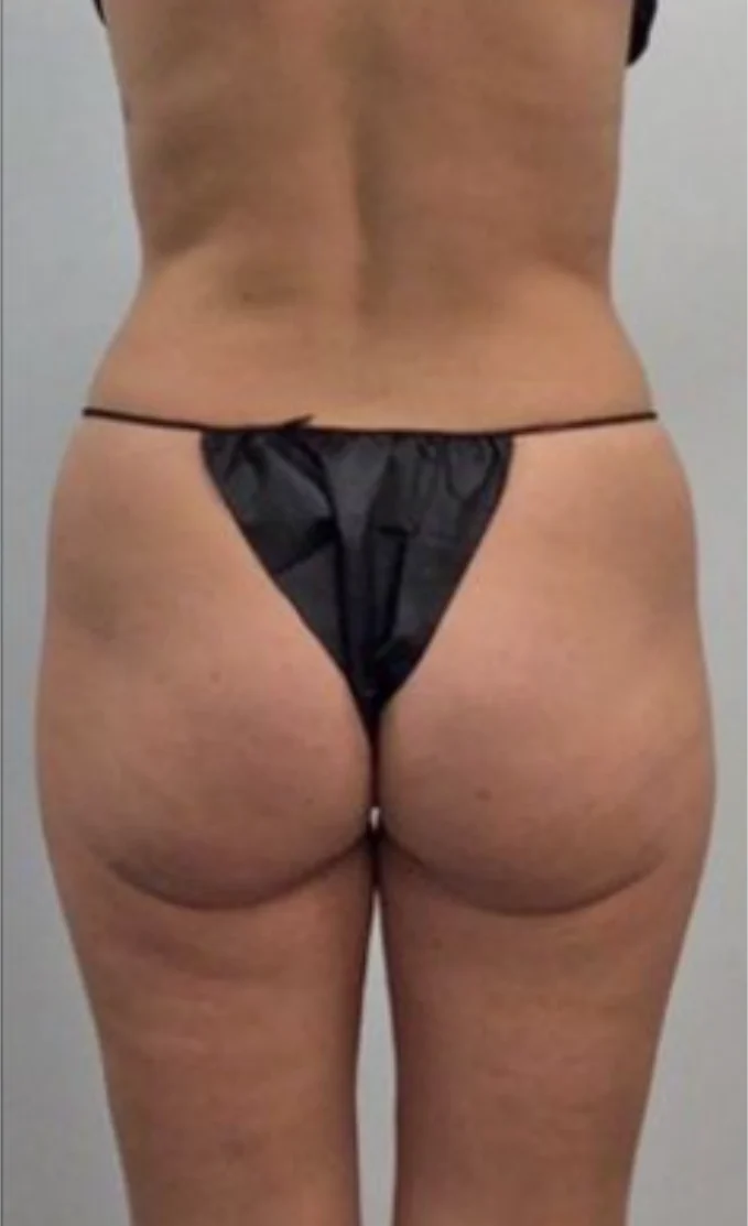 Case 2, before surgery, back view