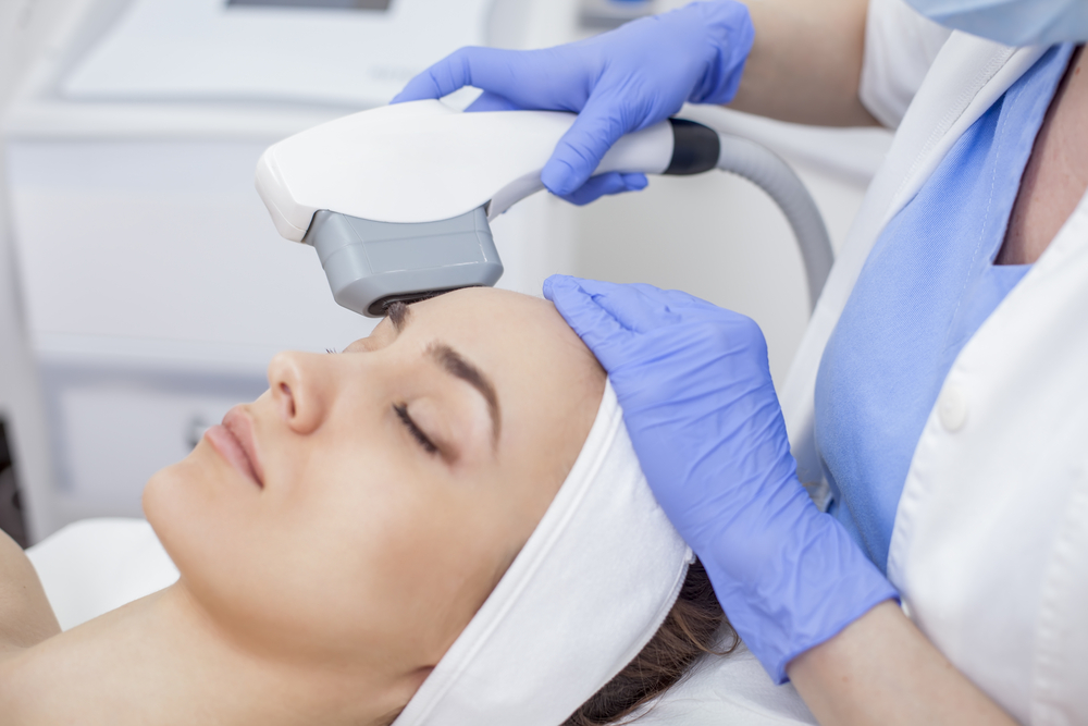 IPL Treatment Washington DC