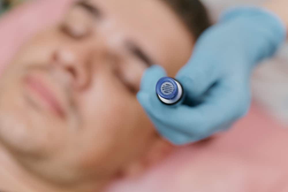 How Fast Will I Get Results From SkinPen Microneedling?