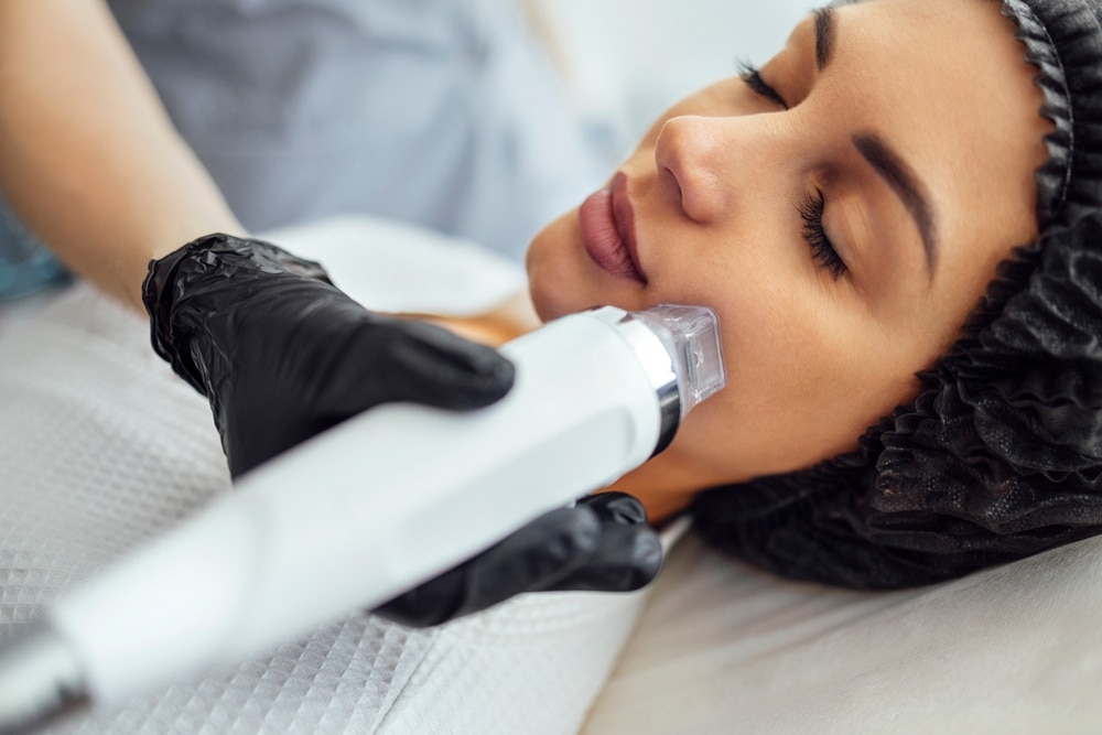 3 Fast Facts About the Best RF Microneedling Cost in DC 