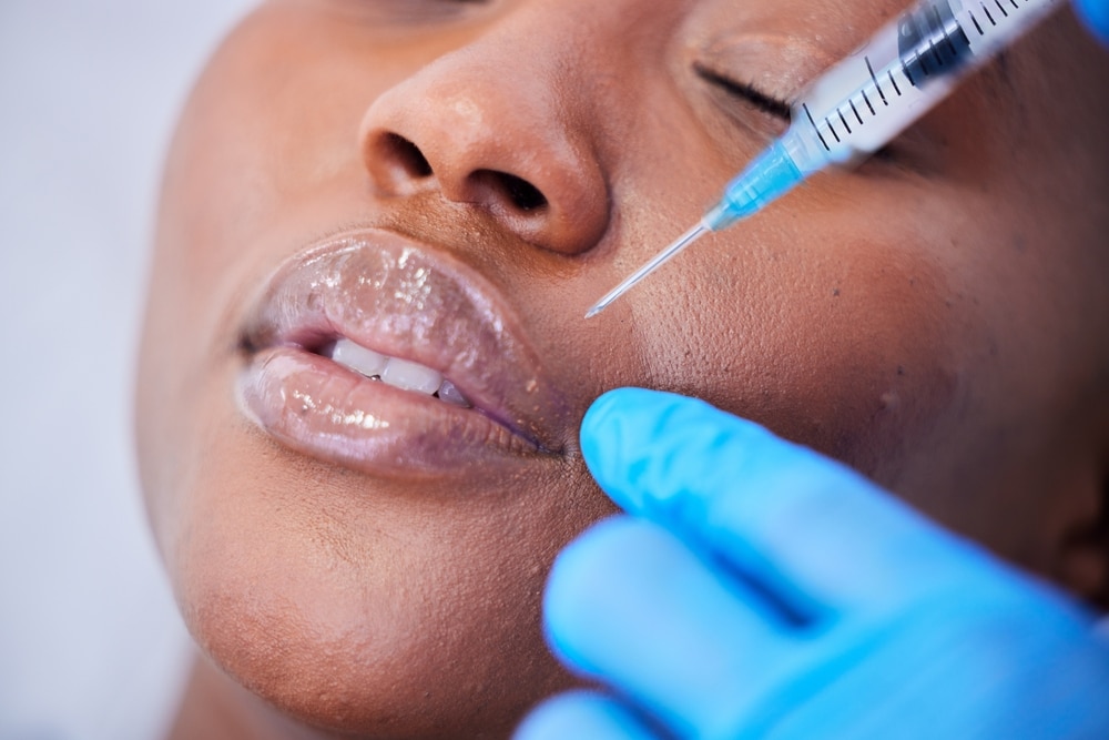 Why You Need the Best Black Dermal Filler Doctor in DC