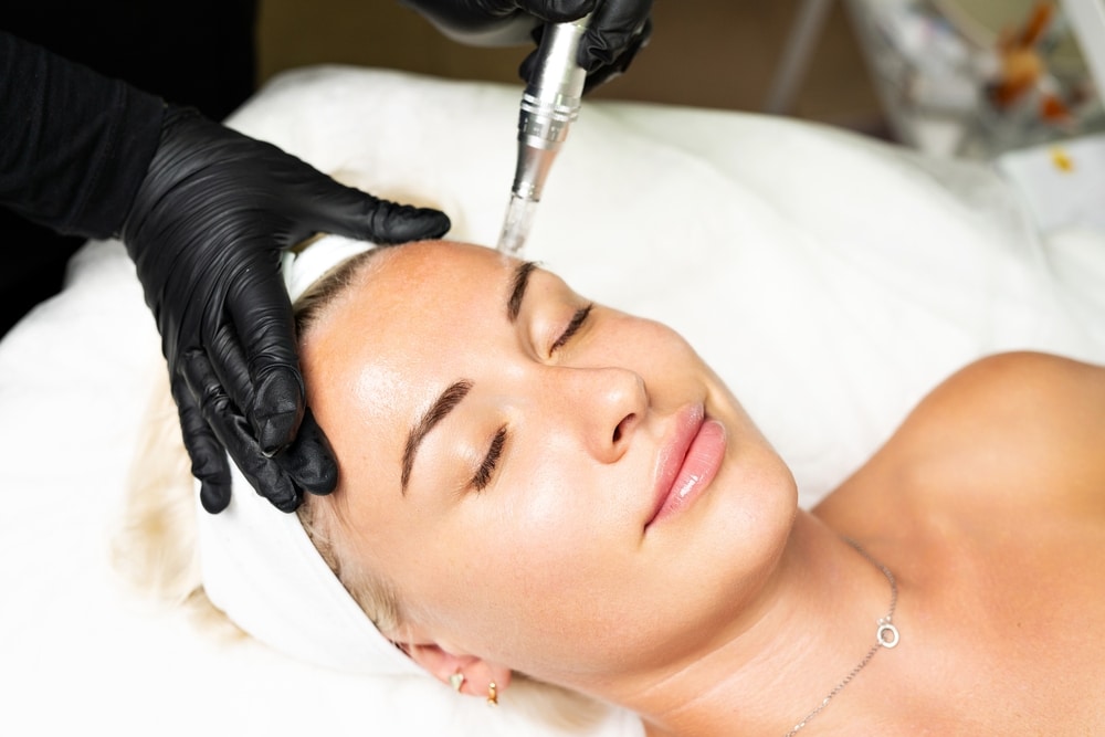 Microneedling Specialist in DC