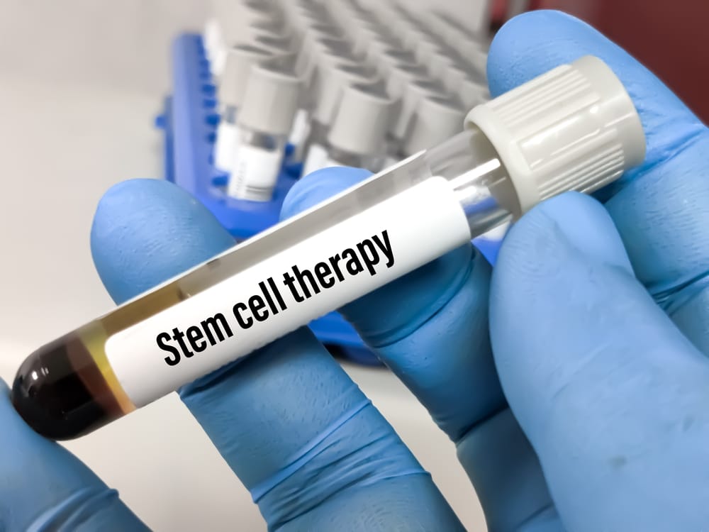 Stem Cell Therapy