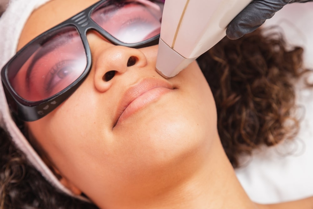 laser hair removal for dark skin in Washington DC