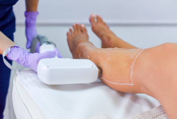 woman getting the best laser hair removal near me in DC