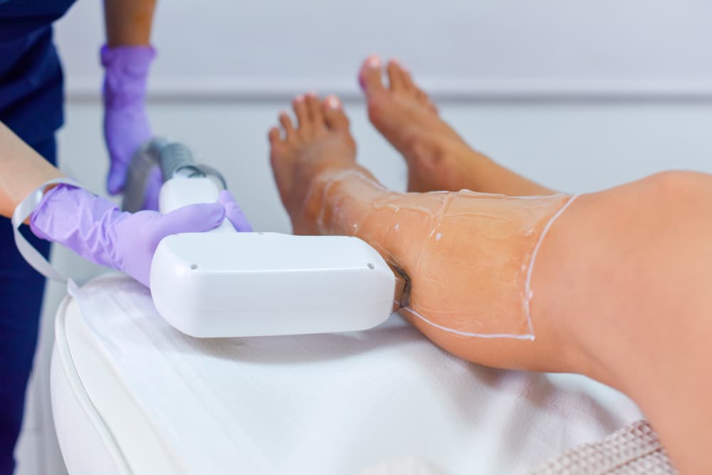 woman getting the best laser hair removal near me in DC