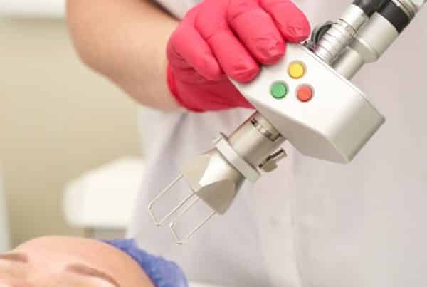 woman about to treat acne scars with a pico laser in DC