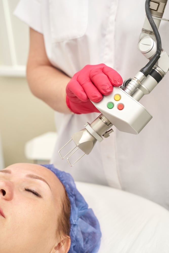 woman about to treat acne scars with a pico laser in DC